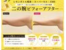 【人気レモンボトル】二の腕・お腹・太ももから選べる41800円→24800円