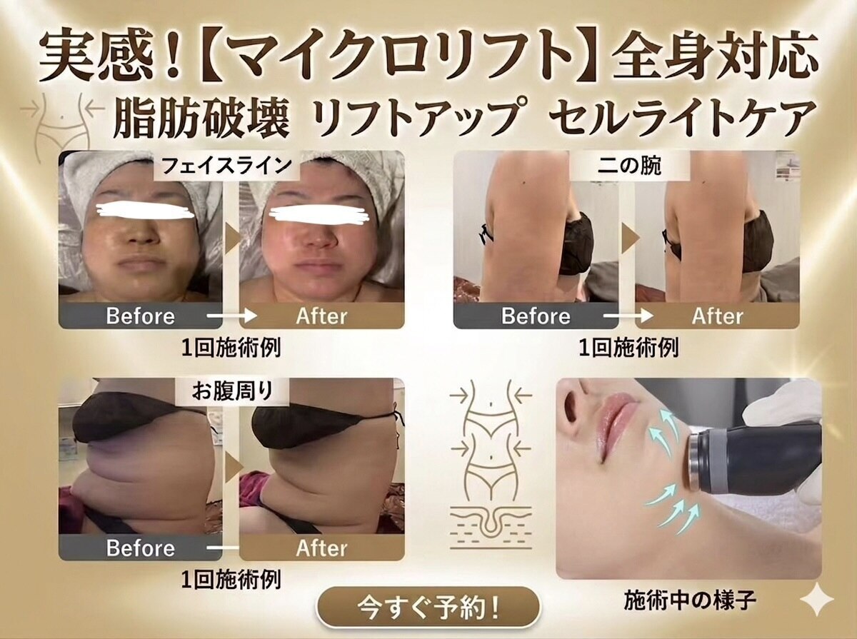 有名エステのパルティール(partir)のSURELINE a です パルティール(PARTIR)｜ホットペッパービューティー