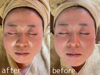 クーラ テュセ(Coeur la Tusais)/筋膜リリースフェイシャル