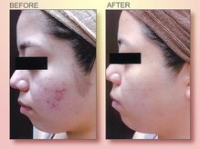 ジュリア オージェ 四条河原町店/ビフォーアフター（フォトFa)