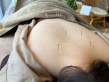 ハリノヒ 大阪院/