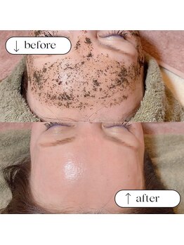 トータルビューティーサロンリア(Li'a)/ビフォー＆アフター