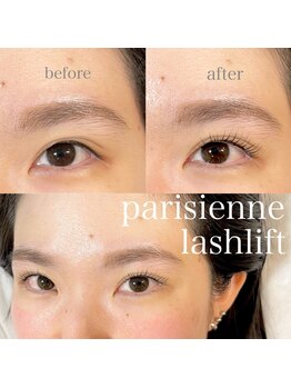 プリエ 中目黒(prie)/瞳を拡大リフトアップ効果◎