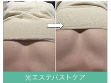 エムグラッティチュード(M gratitude)/