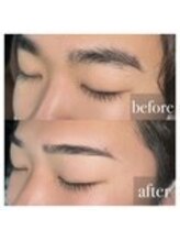 MDラボ 小松清六店/before after