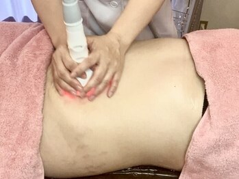 ルポーゼ(Repose)の写真/【ぽっこりお腹の方】最新痩身機器でウエストくびれボディへ☆理想のぺったんこお腹へ♪