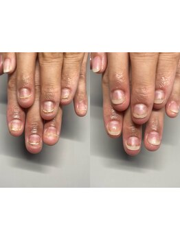 スゴ腕の施術者がいるサロン