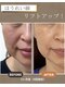けいのき鍼灸整骨院の写真/年齢を重ねるごとに気になるお肌のお悩みを改善！鍼施術でお肌の内側からアプローチし美しく♪ハリツヤUP！