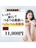 しっかり無くす！特許取得のハイレベル脱毛【VIO】1回¥11,000