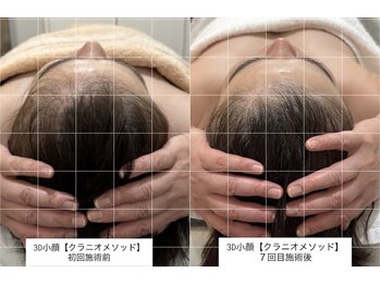 ラ クロワ(la croix)