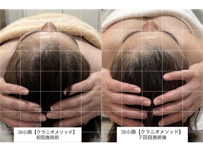 ラ クロワ(la croix)の写真