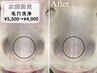 水越限定【毛穴洗浄＆幹細胞ケア】毛穴の角栓・角質除去¥5,500→¥4,000
