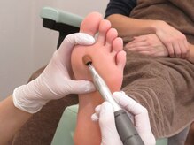 足のトラブルセンター 狸小路店/タコや魚の目も除去