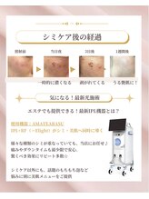 ドットフェイス(.Face)/山形初導入amaterasu