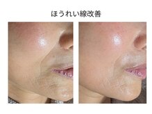 エボルブ 四条烏丸店(EVOLVE)の雰囲気（50代60代の肌改善にも実績！去年から始めた人は今もう綺麗に♪）