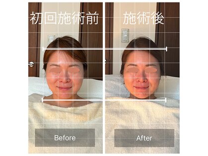 ヌー(NU)の写真