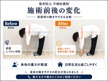 整体院 元 宇城松橋店の雰囲気（#整体院　#腰のビフォーアフター　#腰の施術）