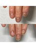 【理想の縦爪へ】最強のネイルケア　育爪３ヶ月コース（計8回）