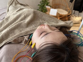 ハリノヒ 大阪院/