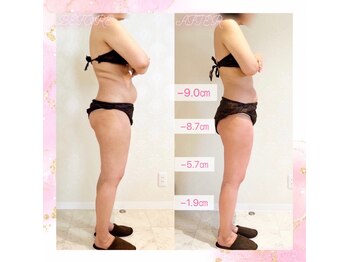 デジール(DESIR)/脚痩★５カ月後のサイズダウン