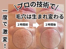 シアン(CYAN)の雰囲気（独自の方法で毛穴ひとつひとつを観察しながら取り除く高度な技術）