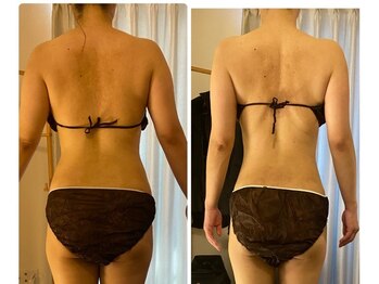 ラリエ 日本橋/3種類の機械　120分MIXコース