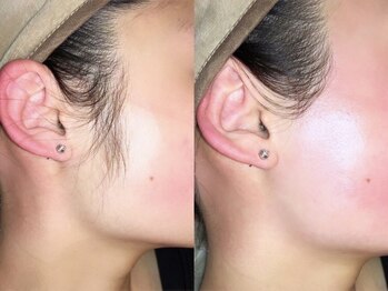 ナビレラ 自由が丘(Navillera)/眉毛＋全顔ワックス＋パック