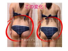 ヨサパーク こらっしぇ御徒町店(YOSA PARK)の雰囲気（都内希少なHHO水素吸入＋ルルオンで圧倒的な結果出し/上野痩身）