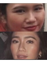 ルシエル/～人生を変える輪郭矯正術～