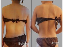 長年行方不明だった肩甲骨が皆さん！発掘できています♪