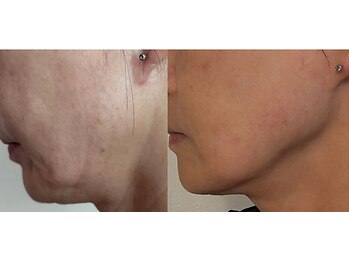 ザエステショップ/