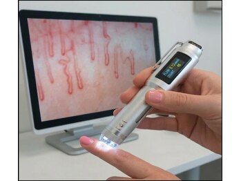 ぷめはな整体/血流チェック