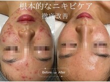 クレア(CLEA)の雰囲気（肌質改善は根本からの改善を。症例写真はフォトギャラリーへ &nbsp;）