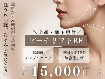 ナビ(NAVI)の写真