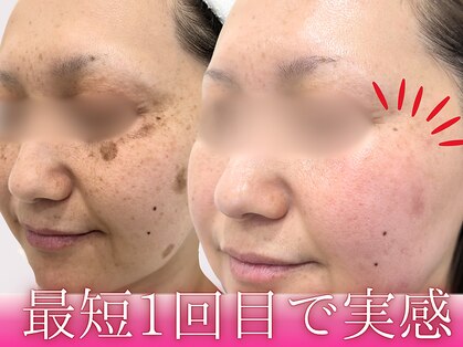 ハウオリ(HAUOLI)の写真