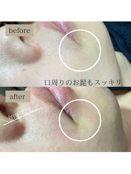 ラニアイラッシュ(Lani eyelash)/【マリムーブフェイシャルWAX】