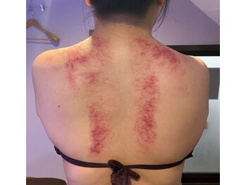 灯香庵 玉響(たまゆら)/【カッサ】首肩～背中