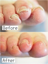 リゼラアンドコー 川越南古谷店/トータルフットキュアコース