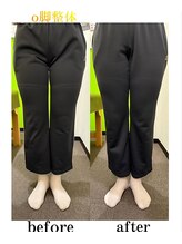 門真わだち整骨院/O脚改善ビフォーアフター