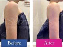 SEC(Shizuoka esthetic company)/【痩身エステ】