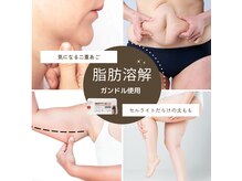 トータルビューティーサロン ヴィヴィエ(ViVier)の雰囲気（フォトギャラリー症例写真/お目元に合わせた種類豊富なパーマ◎）