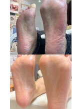 ネイルアトリエ リトム(Nail atelier Litom)/