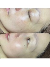 ホワラ 横浜店(Whila)/施術効果5