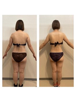 サロンハル(salon HARU)の写真/サイズダウンはハイパーナイフとキャビテーションで脂肪燃焼を徹底ケアで理想のボディへ導きます◎