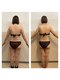 サロンハル(salon HARU)の写真/サイズダウンはハイパーナイフとキャビテーションで脂肪燃焼を徹底ケアで理想のボディへ導きます◎