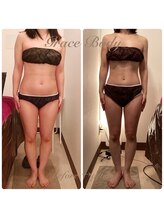グレイスボディ BiViつくば店(Grace Body)/◆痩身　症例写真