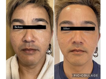 アズリー ルナ(AzRee Luna)/ハーブトリートメント