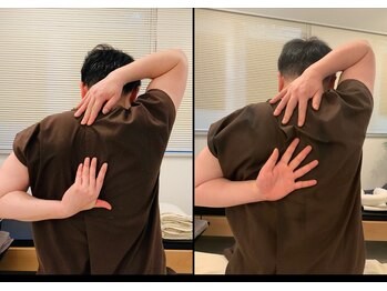 銀座鍼処 カナウ(KANAU)/首肩こり改善例