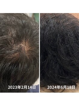 ゆう/オンライン受診+処方で悩み解消