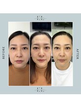 ラプティット(La petite)/40代女性/3回の変化